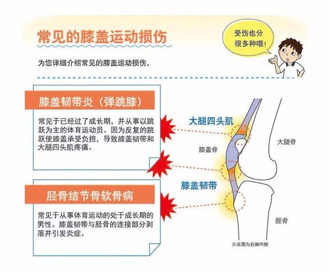 装备推荐必一运动官网 夏季运动保护膝盖的最佳选择：髌骨带(图1)